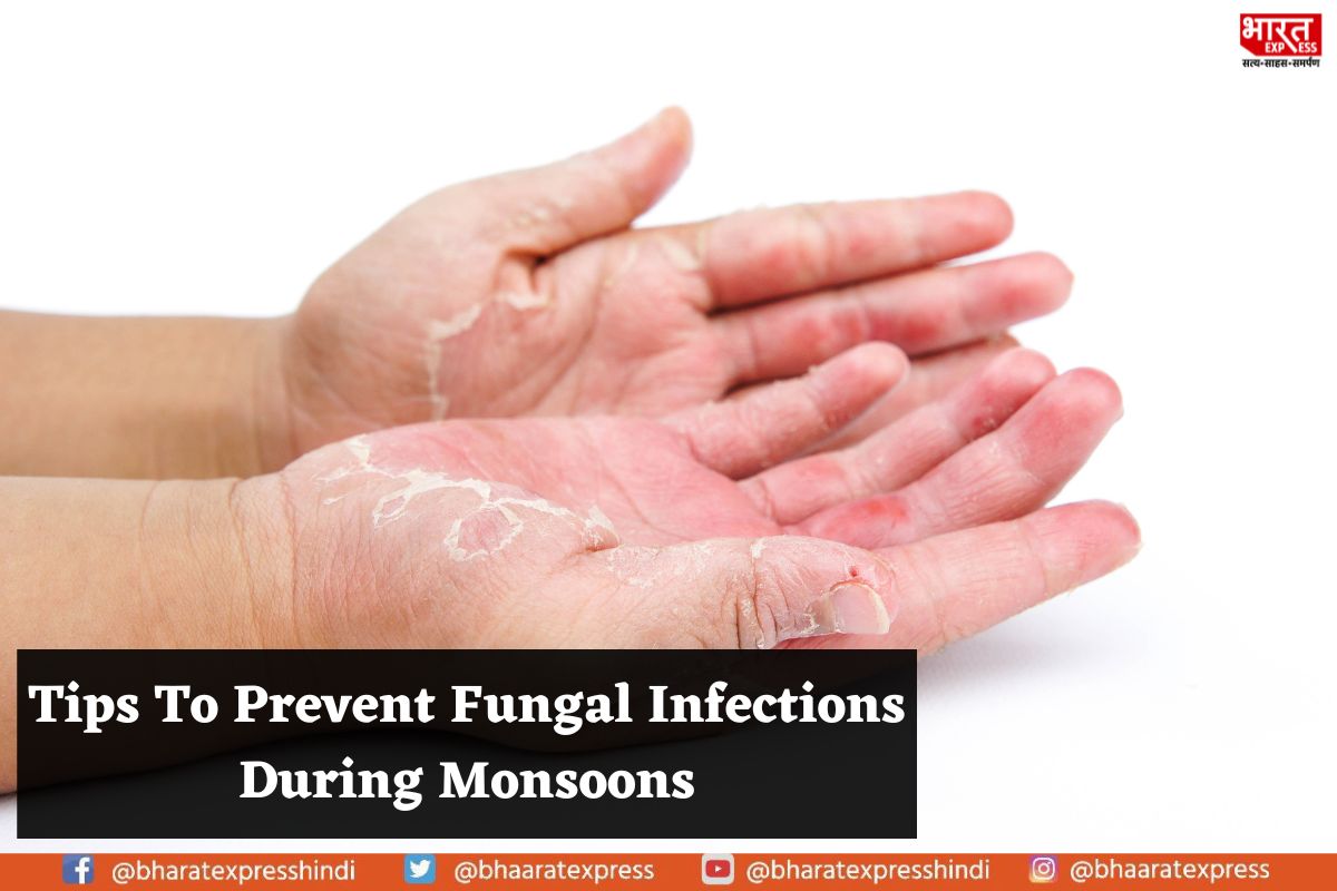 Have a Happy Monsoon: Tips to Keep Fungal Infections at Bay