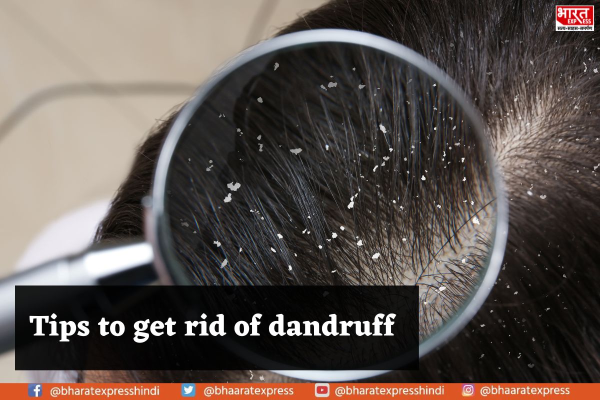 Say Goodbye to Dandruff: Unlock the Secrets to a Flawless Scalp