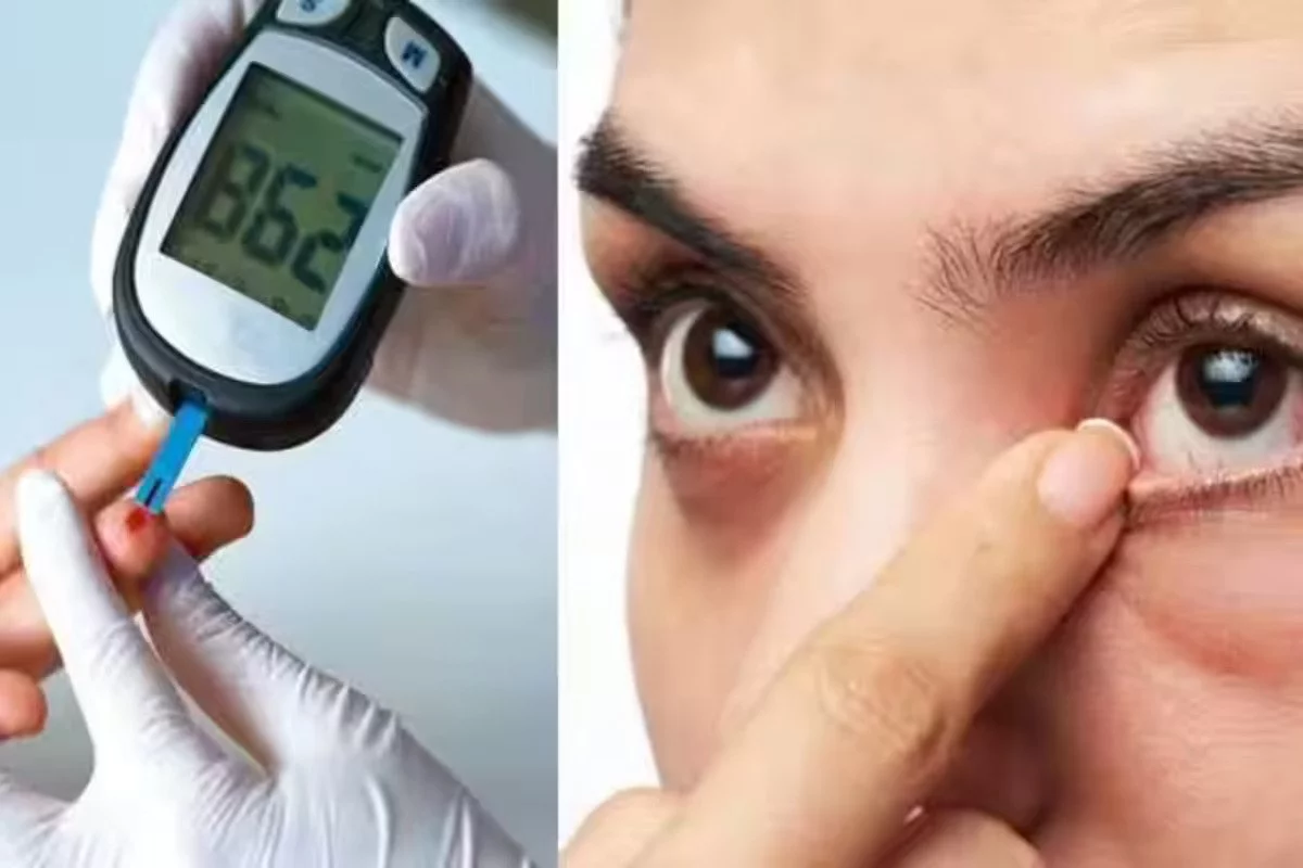 Diabetes Hinders The Healing Process For Eyes: Study