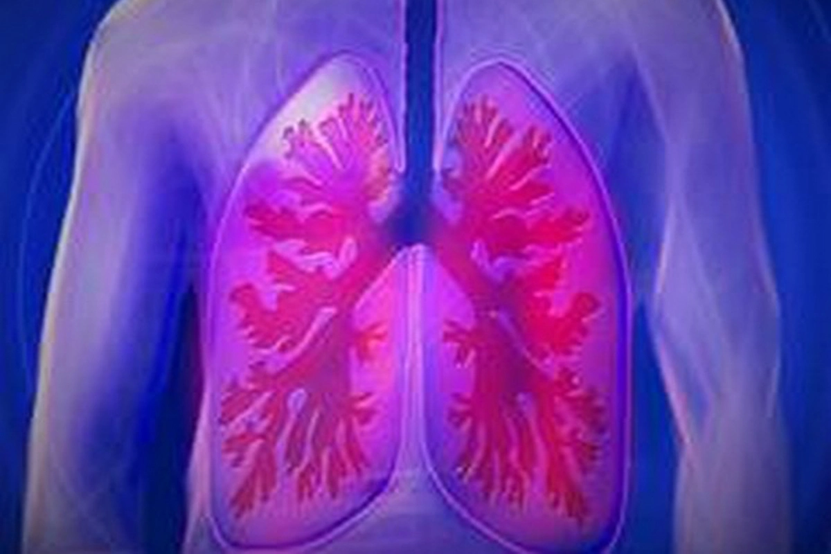 People With Low Vitamin K Levels Have Less Healthy Lungs: Study