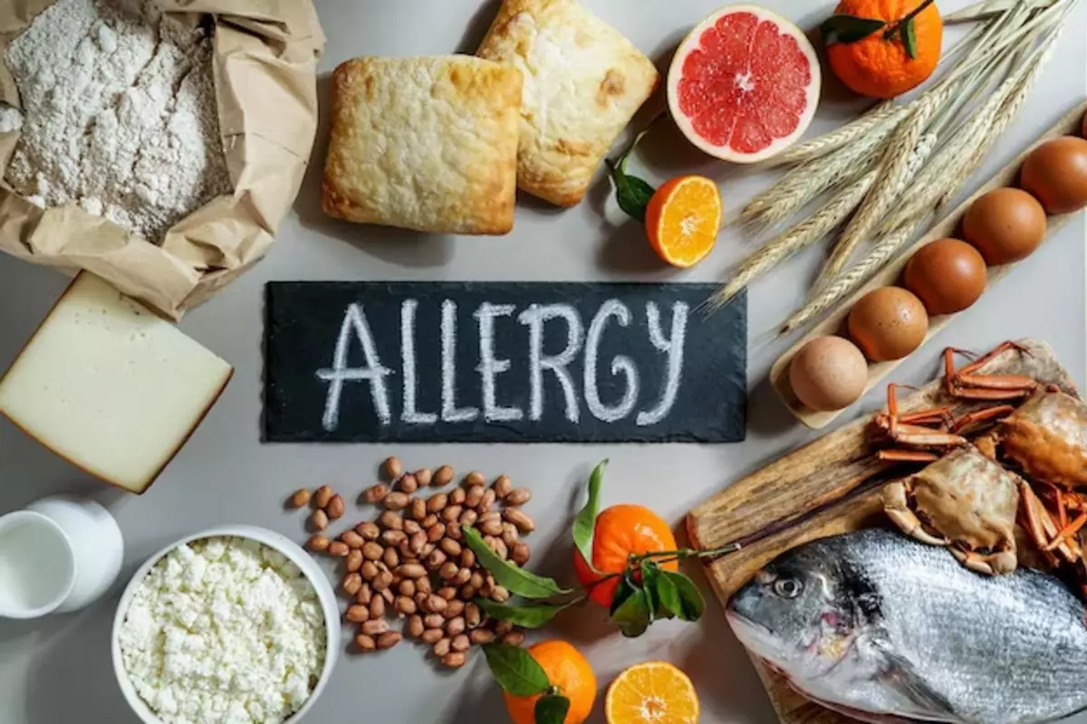 What Is The Difference Between Food Allergy And Intolerance? Symptoms, Causes And Prevention