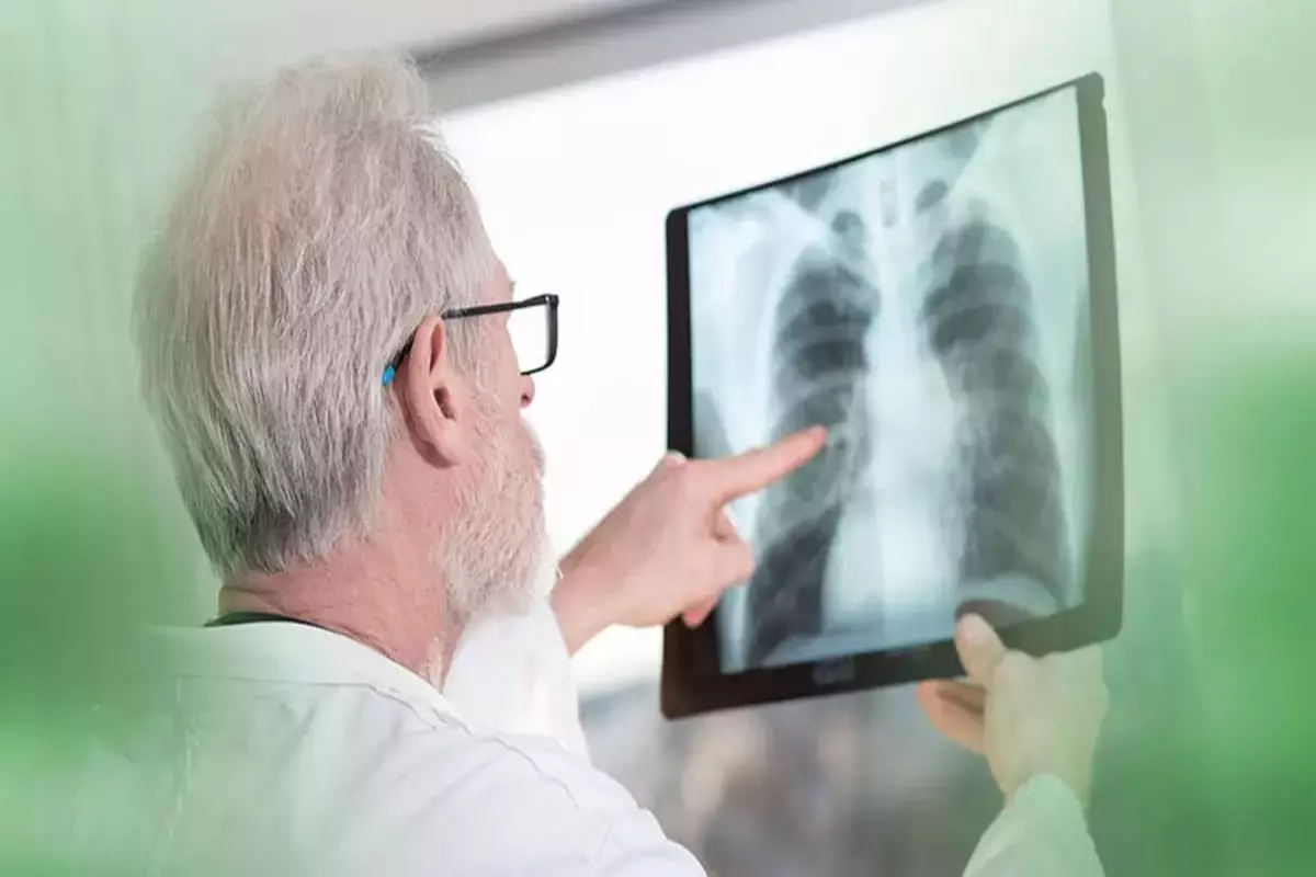IISc Scientists Discover Key Mechanism That Permits Tuberculosis To Remain In Humans For Decades