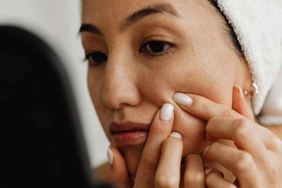 Say Goodbye To Blackheads: Effective Ways To Remove Them For Good