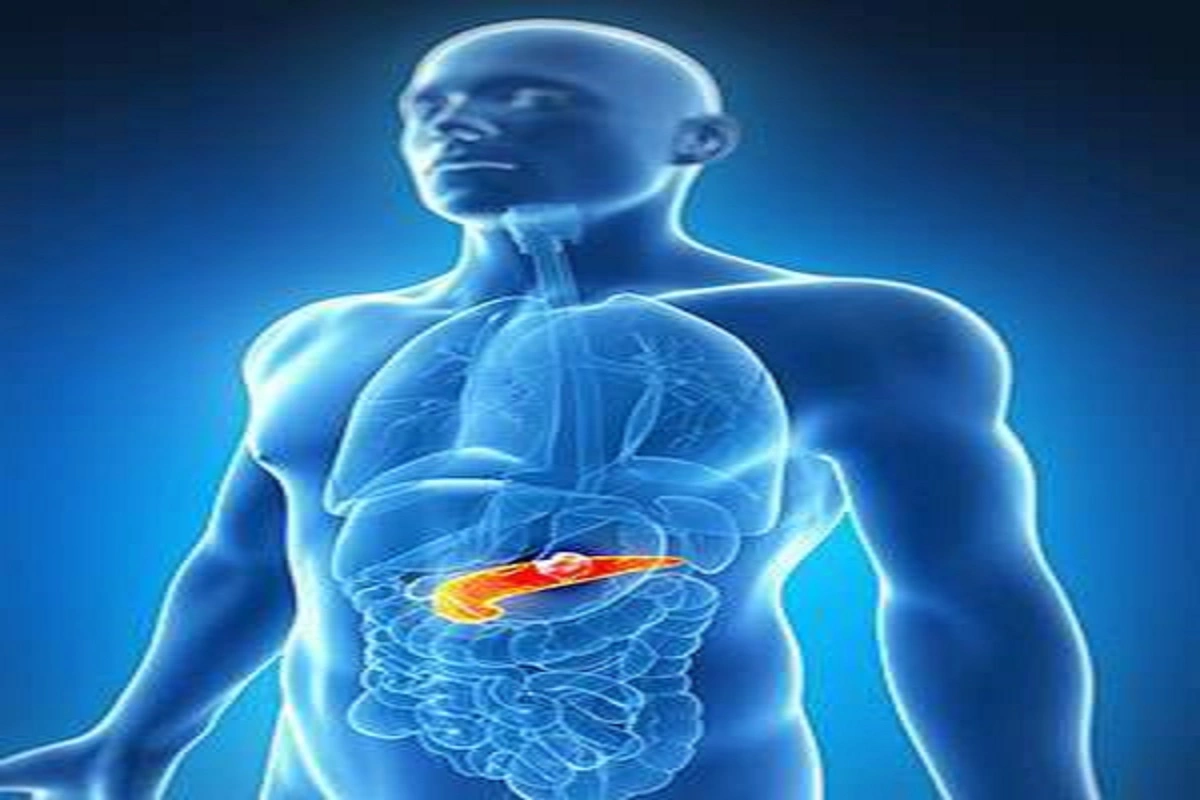 Study Reveals Rising Pancreatic Cancer Rates In Younger Adults; Public Largely Unaware Of Obesity Link