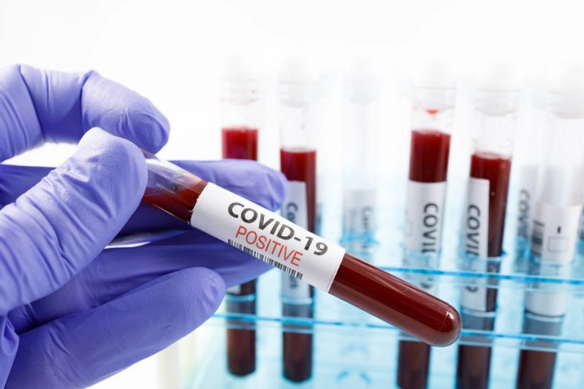 Covid-19 Cases Rise In Bengaluru; Health Ministry Issues Advisory