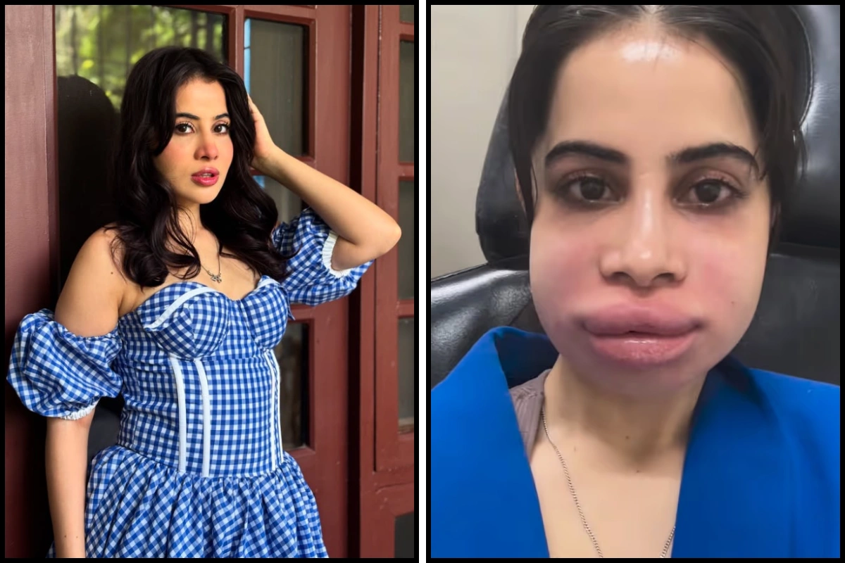 Uorfi Javed Shuts Down Trolls, Shares Face Without Fillers; Promotes Body Positivity