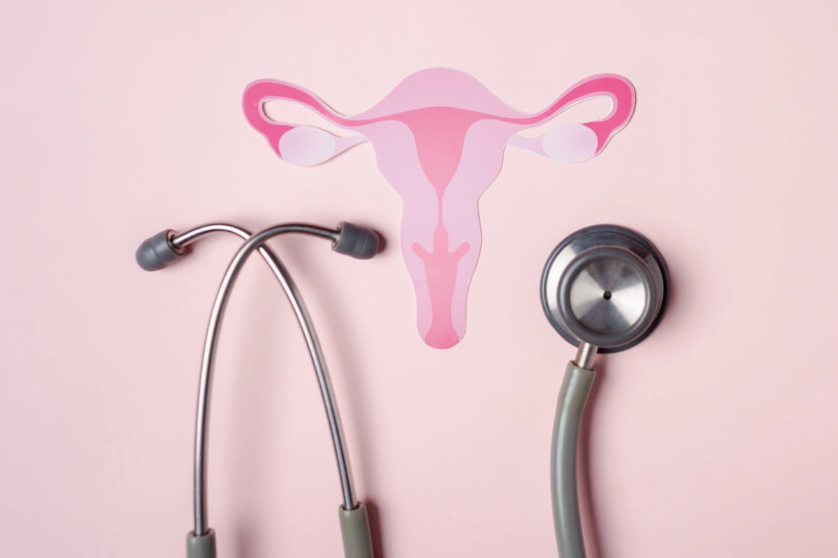 PCOS Management Requires Lifestyle Overhaul, Not Just Medication