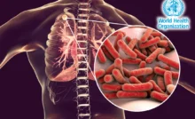 WHO Updates TB Guidelines; Highlights Nutrition In Treatment Following Indian Research