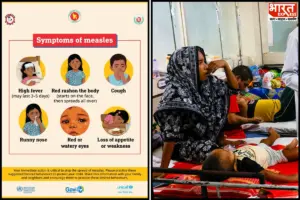 Bangladesh Measles Outbreak Claims 1,009 Lives As Immunity Gaps Widen